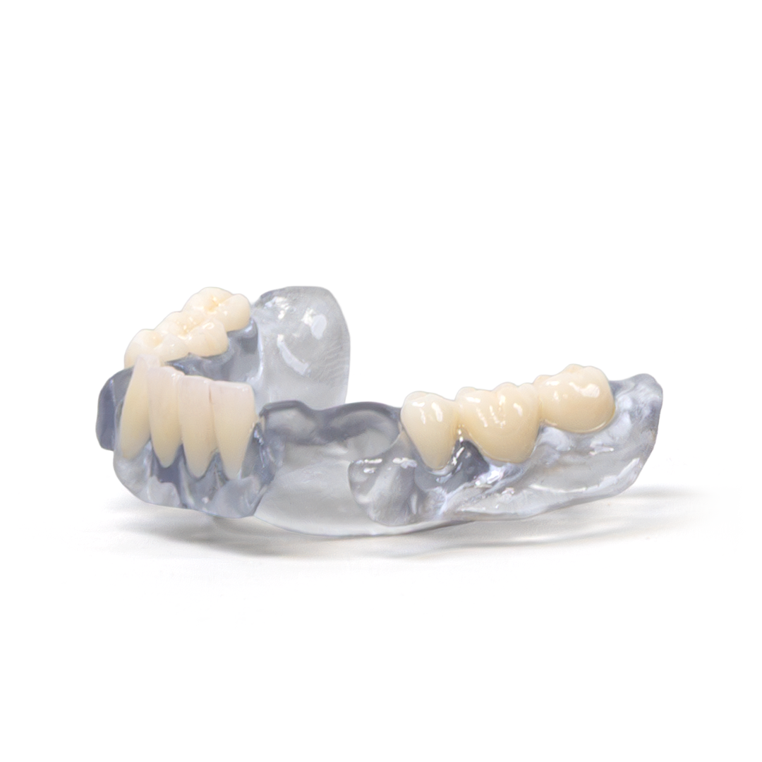 Rodin™ BioArch RPD (1kg)