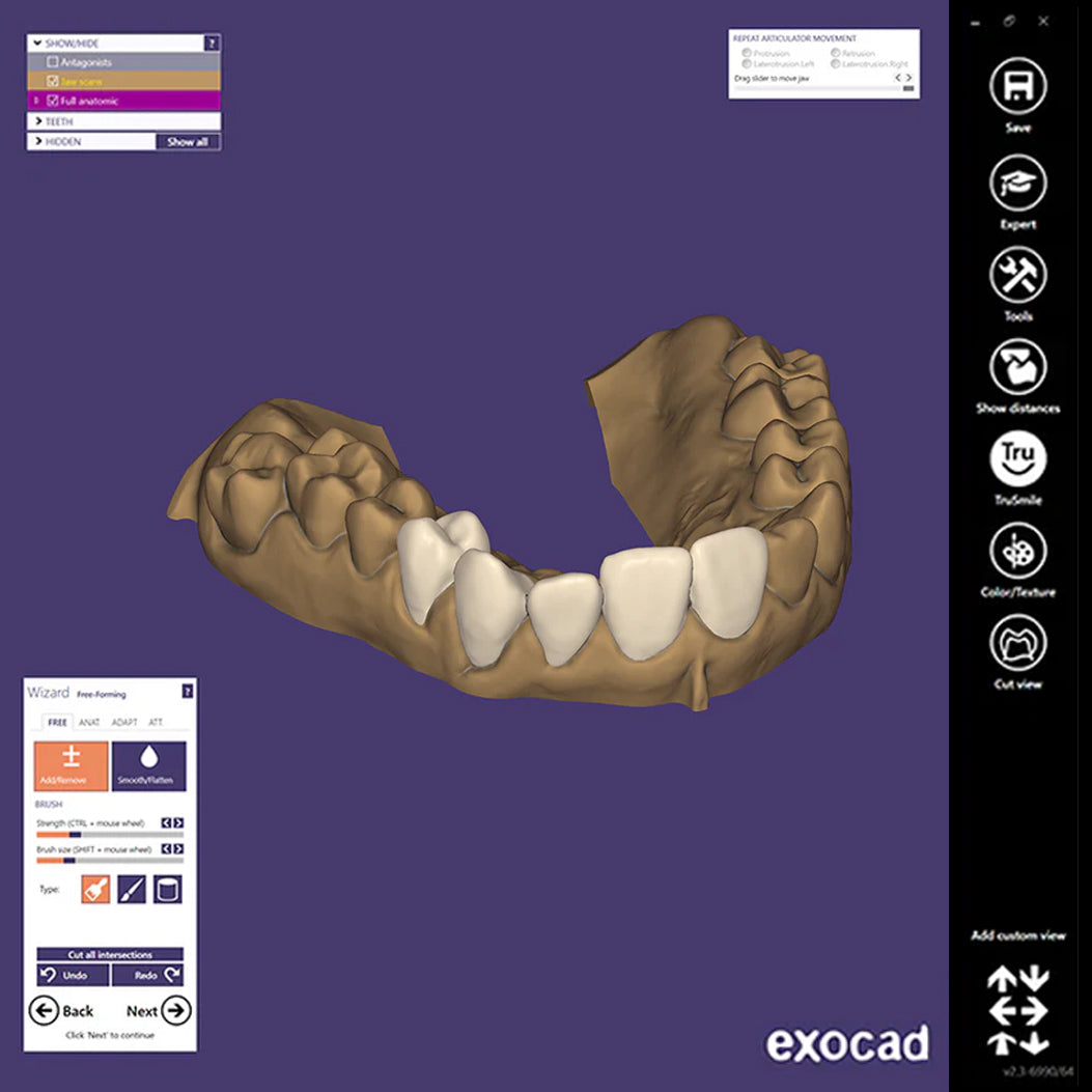 Exocad DentalCAD (for Dental Professionals)