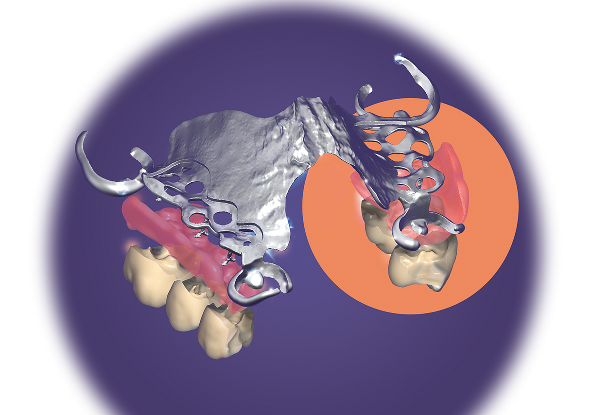Exocad Stand Alone - Partial CAD Module