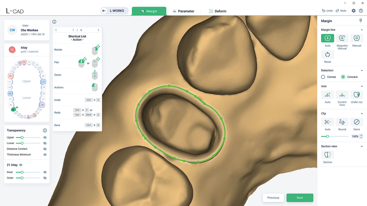 Lilivis SCAN with L-CAD