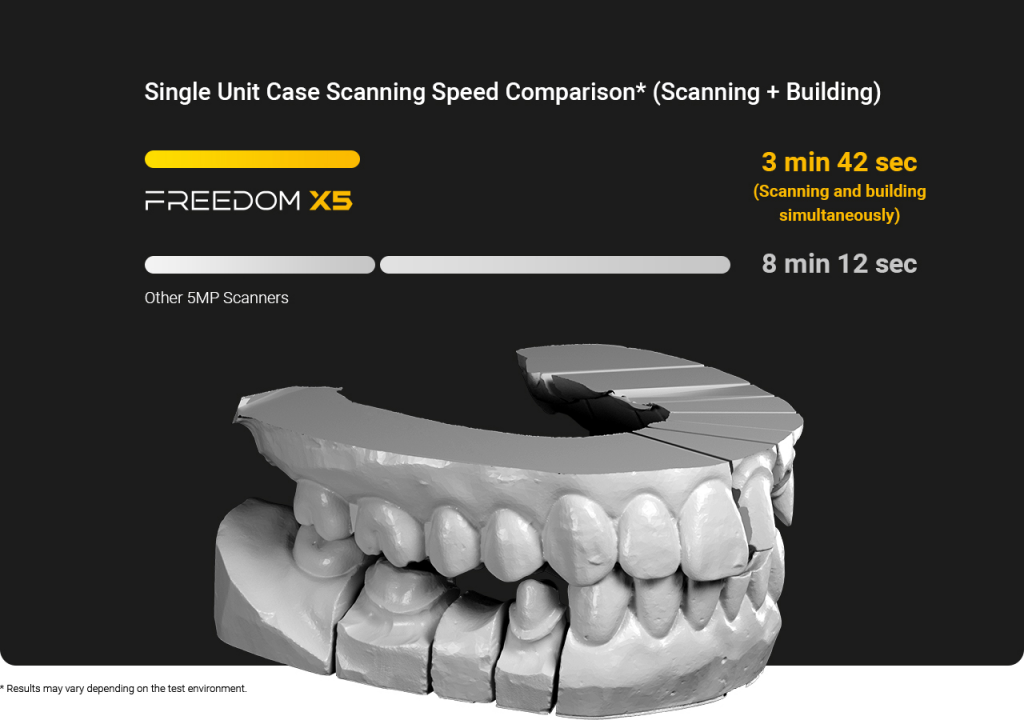 DOF Freedom X5 Model Scanner - Accuracy 5 microns
