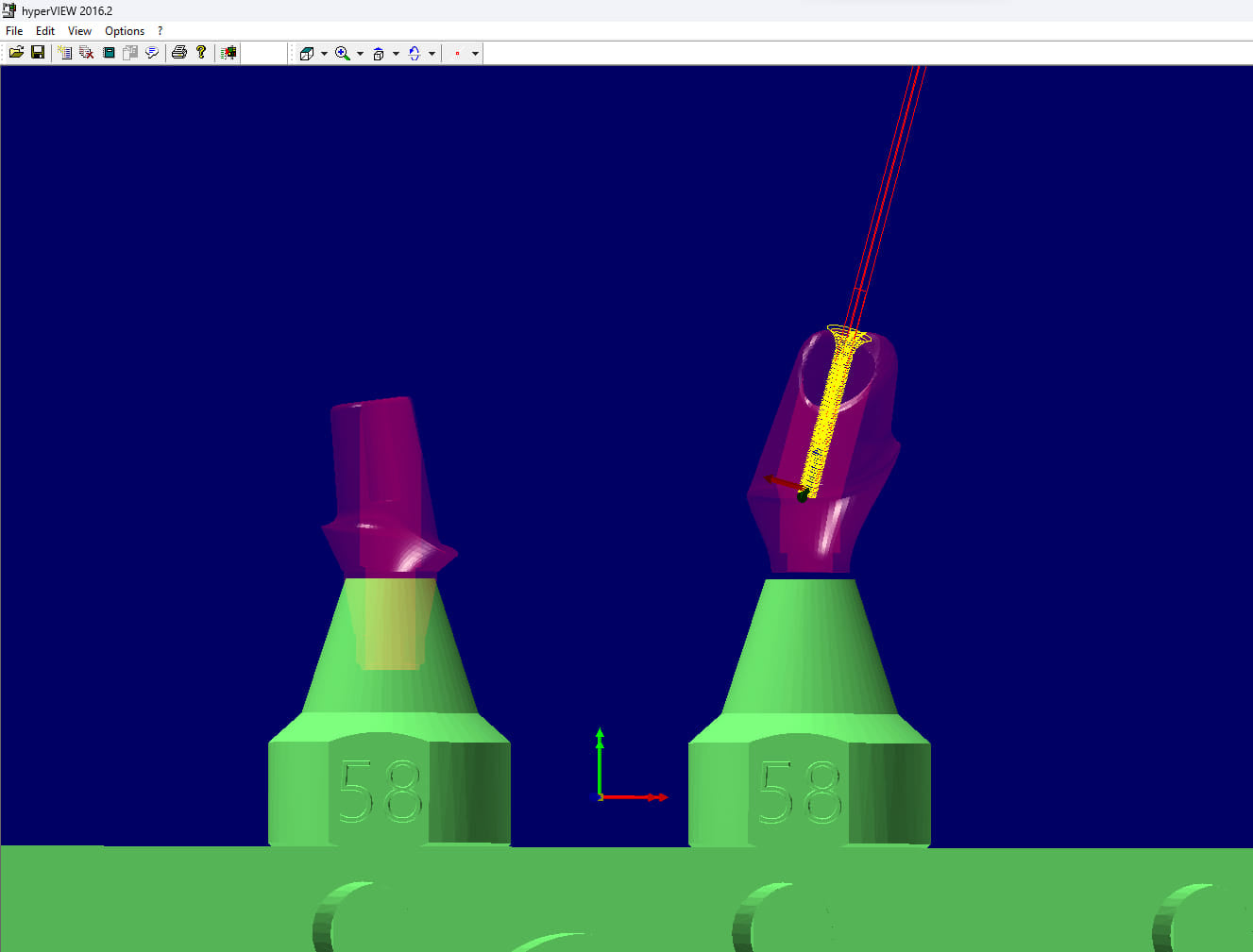Angulated Screw Channel Custom Abutment Milling on Prefabricated Blank
