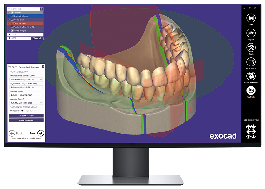 Exocad Design Training Course - Denture (July / Sydney)