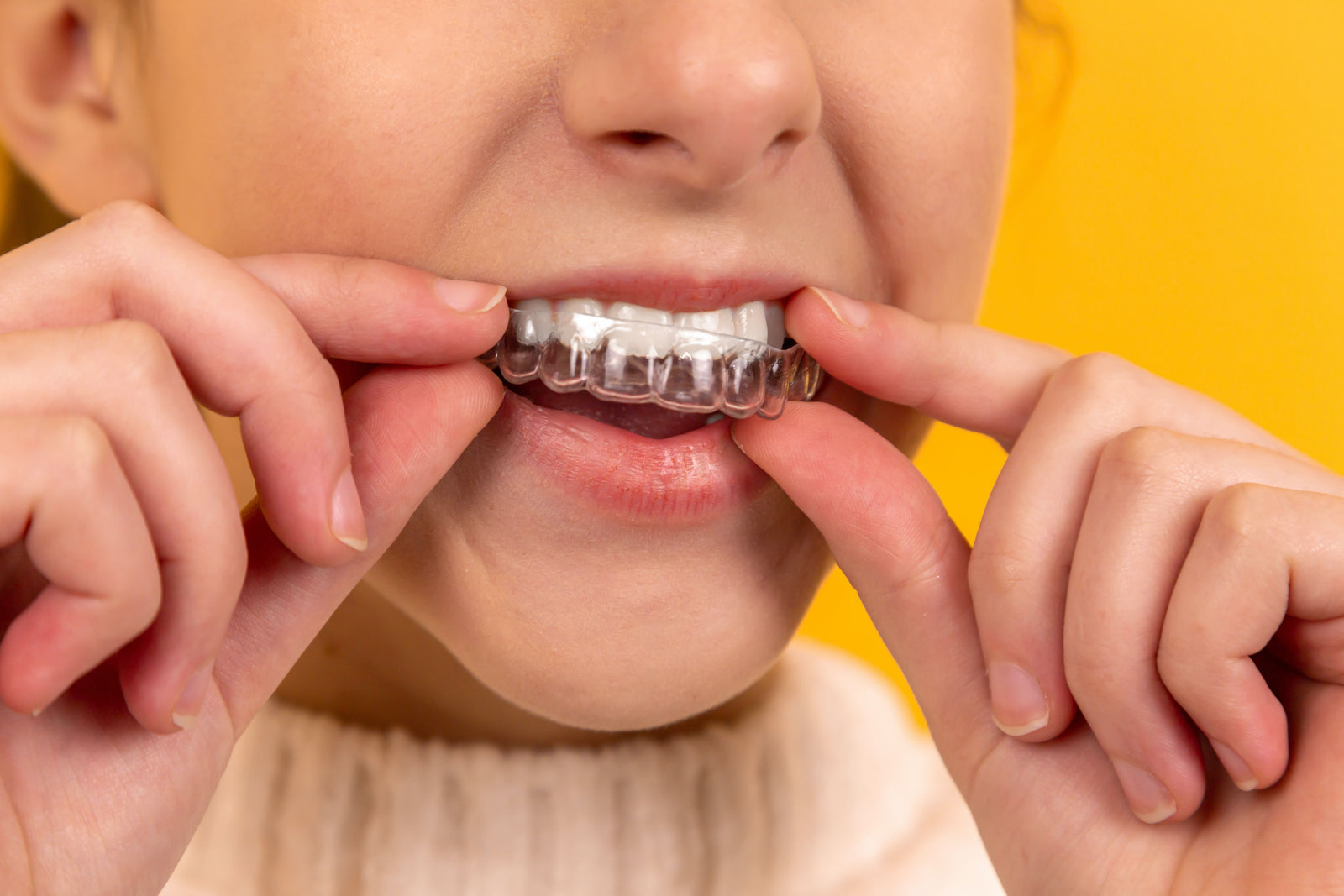 (Finished) Adaptive Orthodontics - In Office Clear Aligner & Treatment Planning (12 DEC 2021)