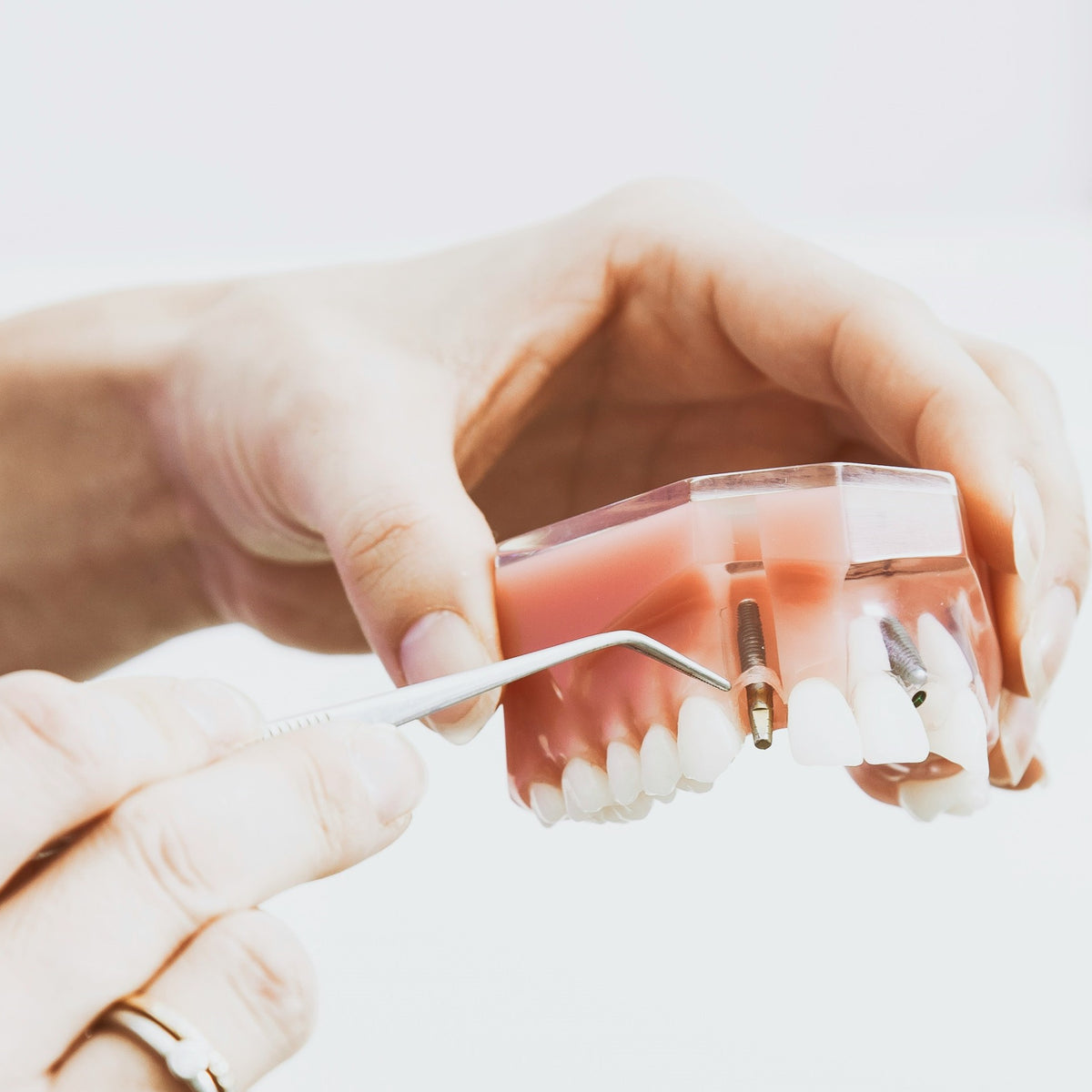 TGA Guideline for Dental Practioner and Dental Technicians about CMMD ...