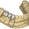 Dental CAD