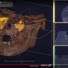 In Office Surgical Guide Solution