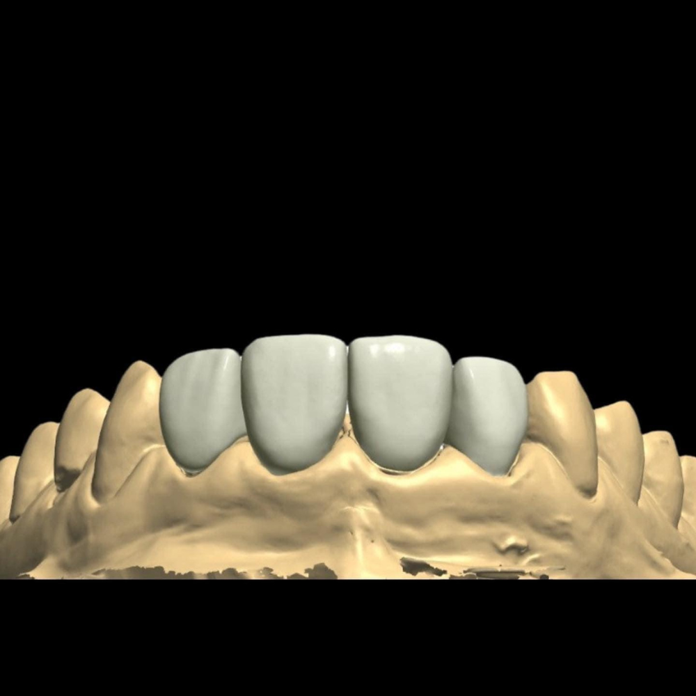 HASS Rosetta® SM - Lithium Disilicate Glass Ceramic Milling Block
