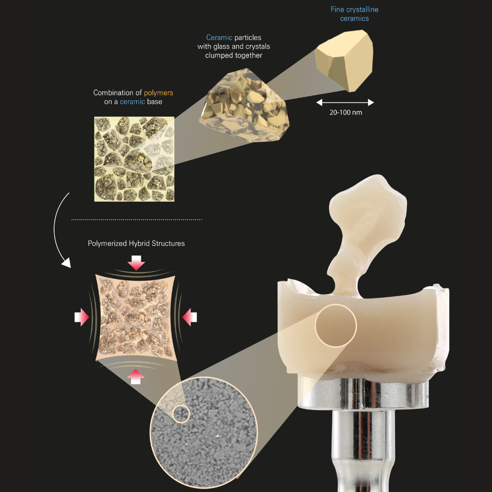 HASS Amber® Mill H - Hybrid Ceramic Block