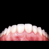 HASS Rosetta® SM - Lithium Disilicate Glass Ceramic Milling Block