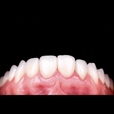 HASS Rosetta® SM - Lithium Disilicate Glass Ceramic Milling Block