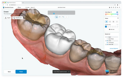 Dentbird AI Crown Design