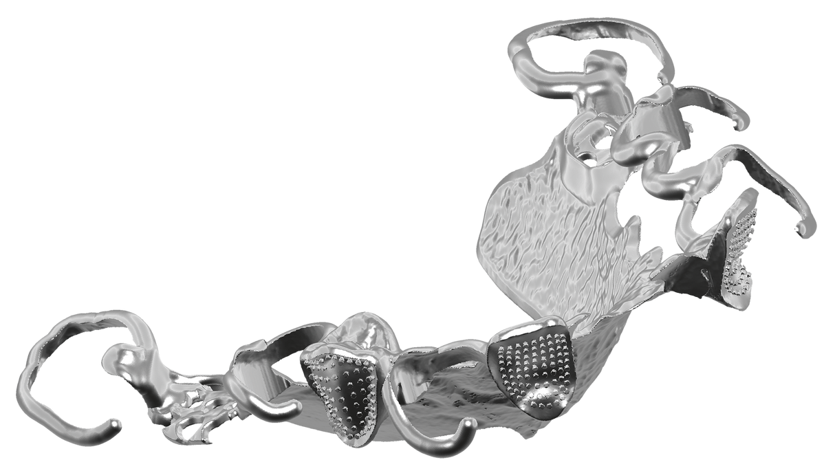 Exocad Stand Alone - Partial CAD Module