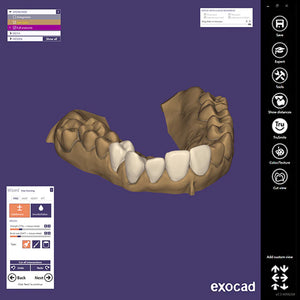 Exocad DentalCAD (for Dental Professionals)