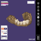 Exocad DentalCAD (for Dental Professionals)