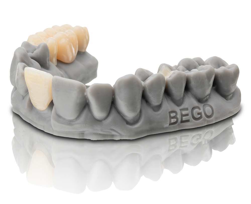 BEGO VarseoSmile TriniQ 500g - Permanent Crown