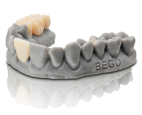 BEGO VarseoSmile TriniQ 500g - Permanent Crown