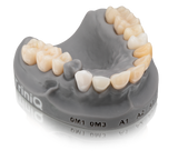 BEGO VarseoSmile TriniQ 500g - Permanent Crown