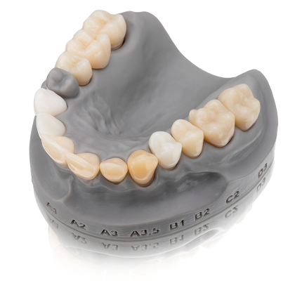 BEGO VarseoSmile TriniQ 500g - Permanent Crown