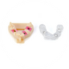Implantology