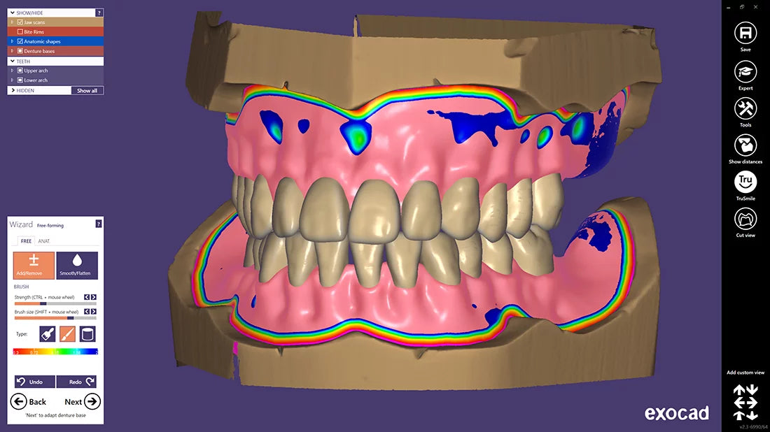 Exocad Stand Alone