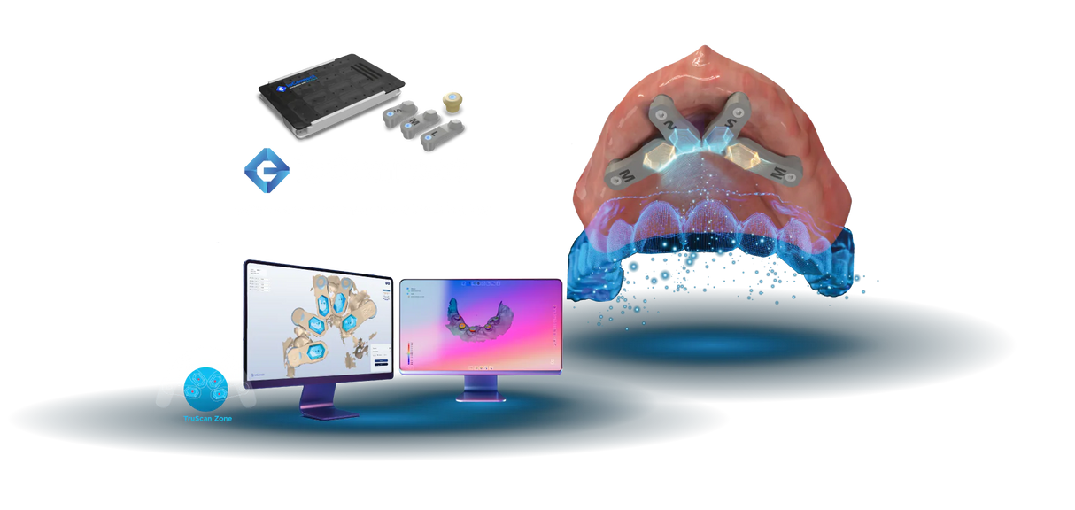 ioConnect Scanbody for AoX on MUA