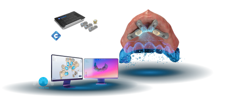 ioConnect Scanbody for AoX on MUA