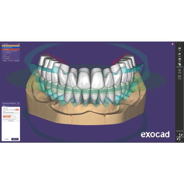 Exocad File Exocad Video Tutorial Full Denture Design Youtube