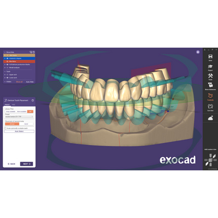Exocad Stand Alone - Full Denture incl. Ivotion Add-On