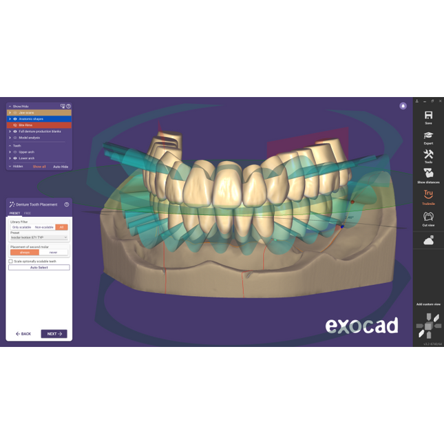 Exocad Stand Alone - Full Denture incl. Ivotion Add-On