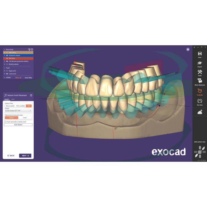 Exocad Stand Alone - Full Denture incl. Ivotion Add-On