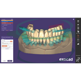 Exocad Stand Alone - Full Denture incl. Ivotion Add-On