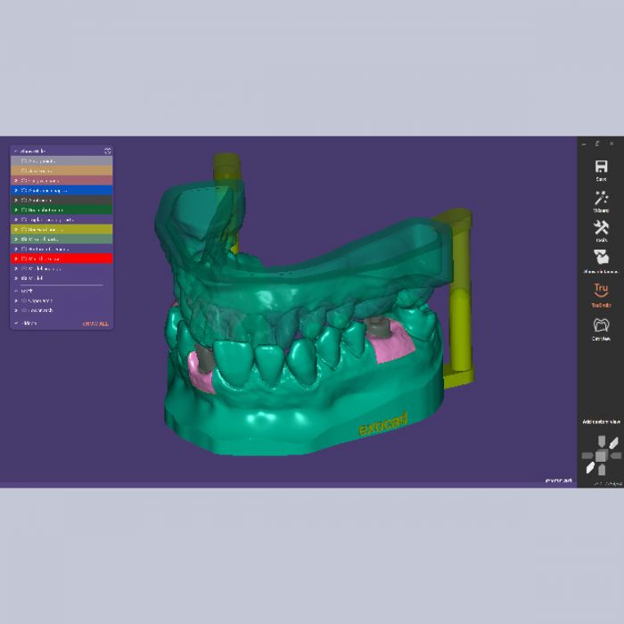 Exocad Stand Alone  - Model Creator