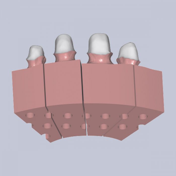 Exocad Stand Alone  - Model Creator