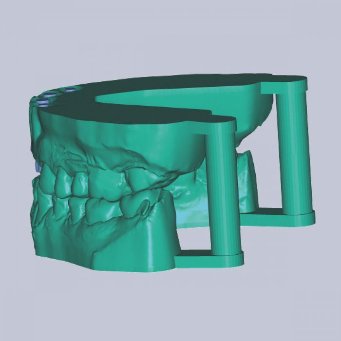 Exocad Stand Alone  - Model Creator