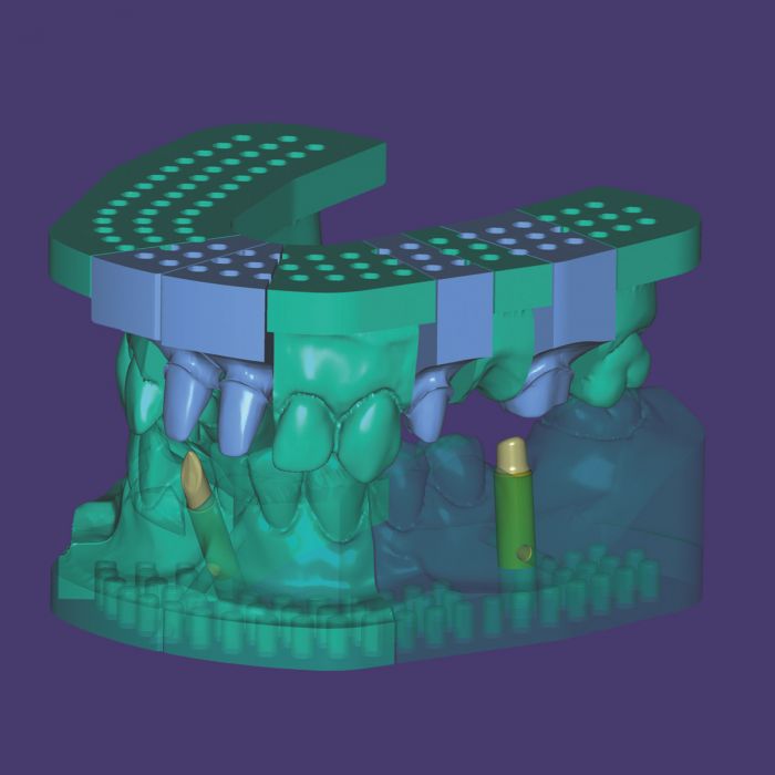 Exocad Stand Alone  - Model Creator