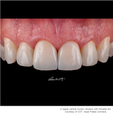 HASS Rosetta® SM - Lithium Disilicate Glass Ceramic Milling Block