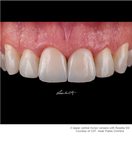 HASS Rosetta® SM - Lithium Disilicate Glass Ceramic Milling Block