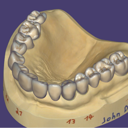 Exocad DentalCAD (for Dental Professionals)