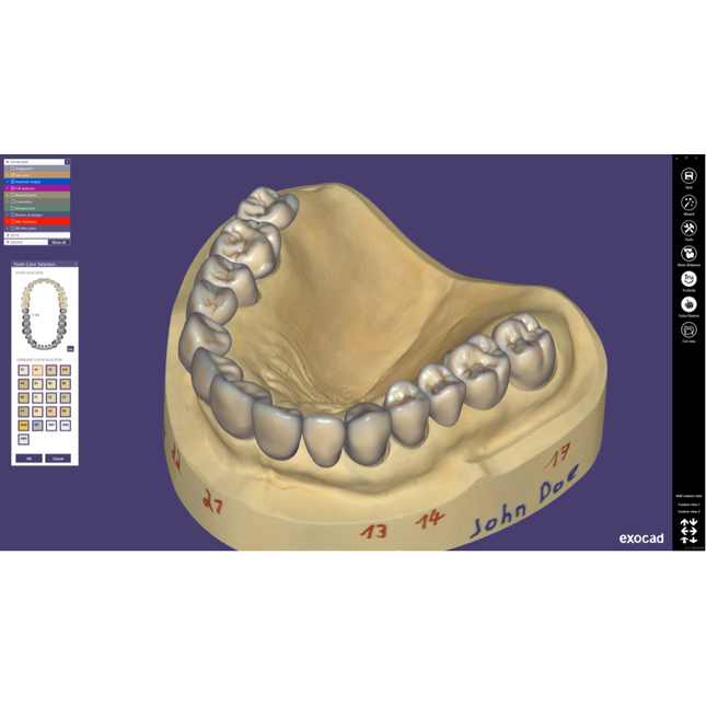 Dental CAD – CM MEDICAL - Digital Dentistry Solution Provider