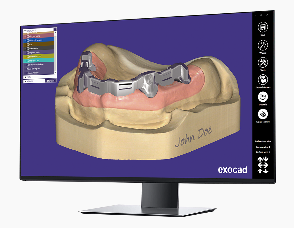 Exocad DentalCAD (for Dental Professionals)