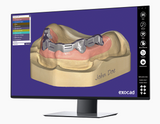 Exocad DentalCAD (for Dental Professionals)