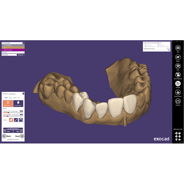 Exocad DentalCAD (for Dental Professionals)