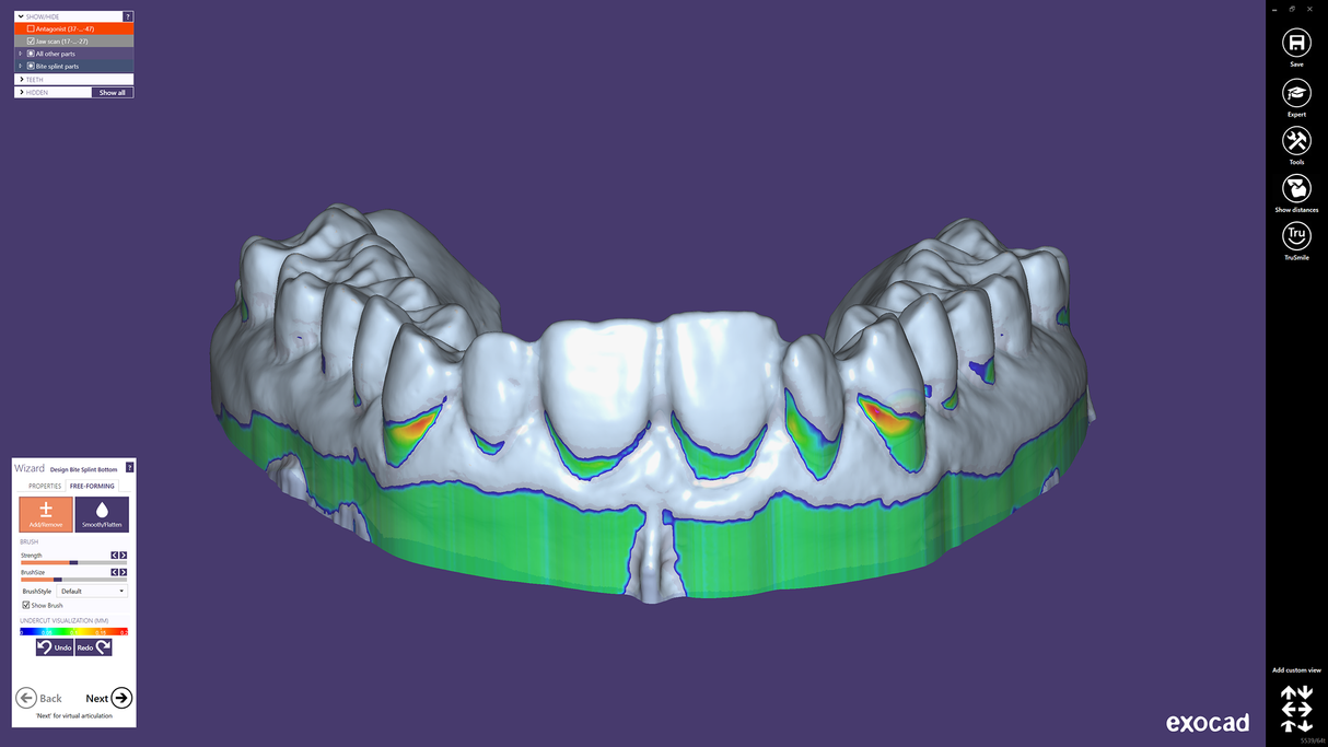 Exocad DentalCAD (for Dental Professionals)