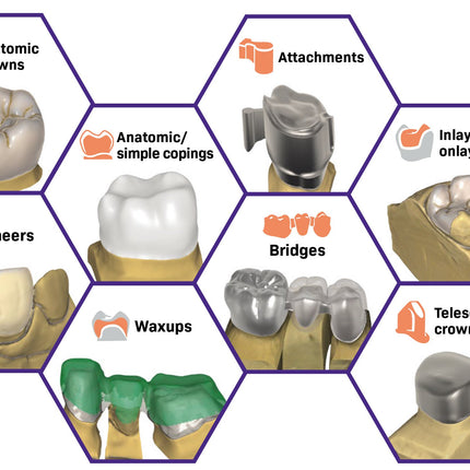 Exocad DentalCAD (for Dental Professionals)