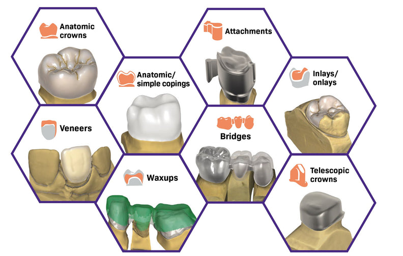 Exocad DentalCAD (for Dental Professionals)
