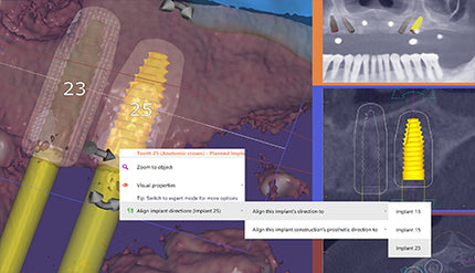 Exoplan (Surgical Guide by Exocad)